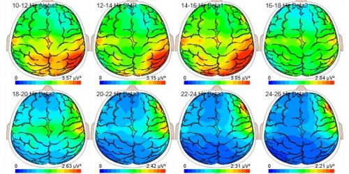 BrainView Picture